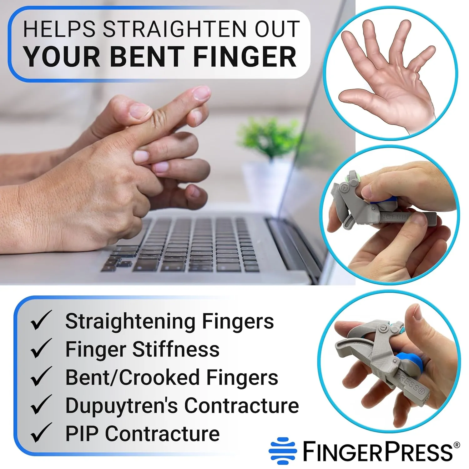 Finger Straightener | PIP Extension Orthosis/Splint For Bent Fingers, PIP Flexion Contractures | Adjustable Joint Stretcher Device | Made in USA | Gray/X-Large